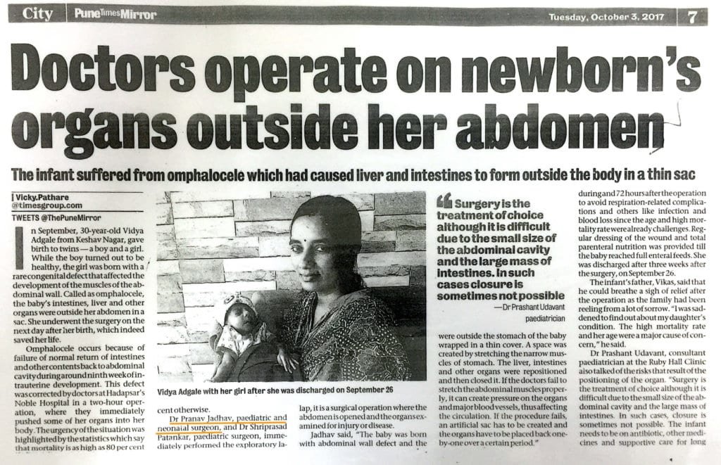 doctors-operate-on-newborns-organs-outside-her-abdomen